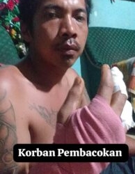 Ket foto: Wanda Barus Korban Pembacokan OTK usai mendapat perawatan medis(ist)