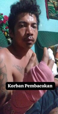 Ket foto: Wanda Barus Korban Pembacokan OTK usai mendapat perawatan medis(ist)